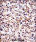 HTATIP2 Antibody (N-term)